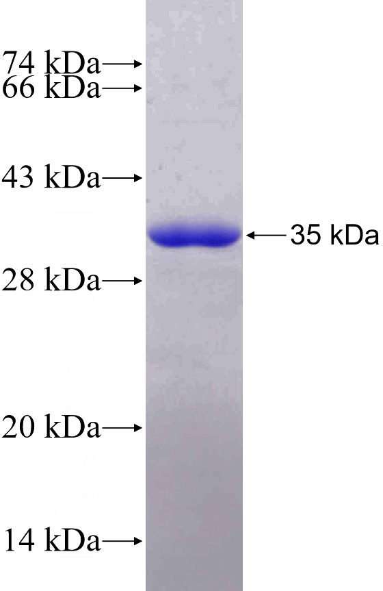 Recombinant Human PCM1 SDS-PAGE