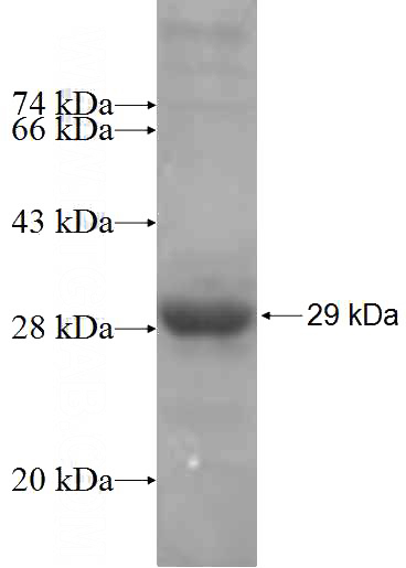 Recombinant Human AIFM3 SDS-PAGE