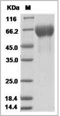 Influenza A H3N2 (A/Hanoi/EL134/2008) Hemagglutinin / HA1 Protein (His Tag)