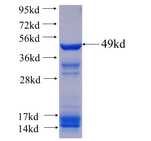 Recombinant human PTK2B SDS-PAGE