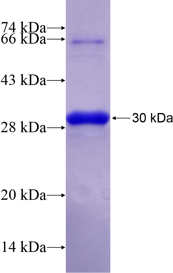 Human DUSP11 Recombinant protein (6*His tag)