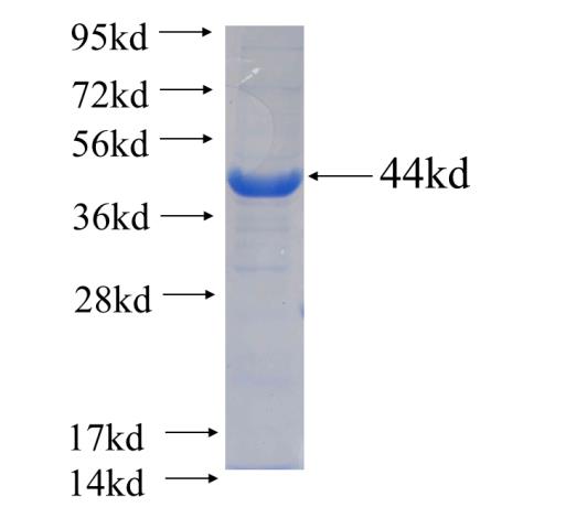 Recombinant human ALDH8A1 SDS-PAGE