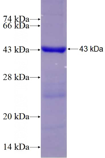 Recombinant Human ACTR2 SDS-PAGE