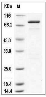 Mouse GAD65 / GAD2 Protein (His & GST Tag) SDS-PAGE