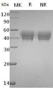 Human SERPINA5/PCI/PLANH3/PROCI (His tag) recombinant protein