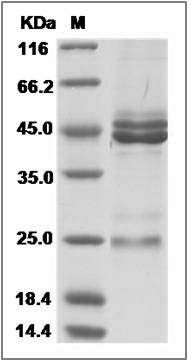 Rat IL-23 (IL23A & IL12B Heterodimer) Protein SDS-PAGE