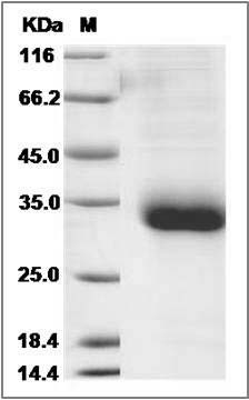 Cynomolgus Interferon alpha-B / IFNA8 Protein (His Tag) SDS-PAGE