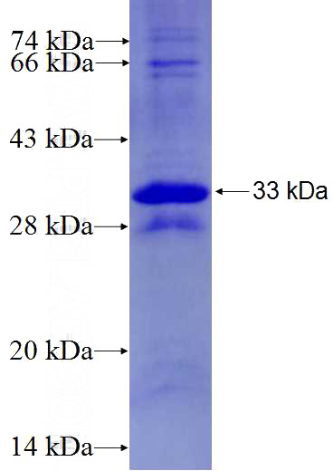 Recombinant Human CYFIP1 SDS-PAGE