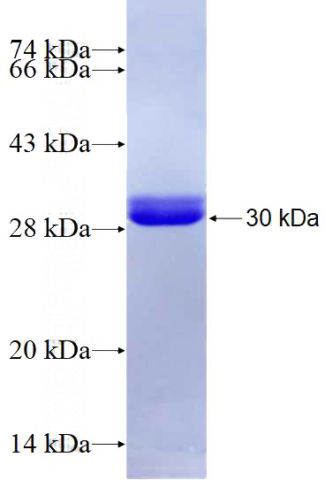 Recombinant Human DMXL2 SDS-PAGE