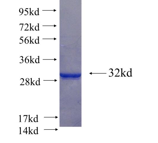 Recombinant human BHLHE23 SDS-PAGE