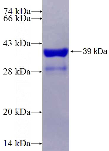 Recombinant Human RPS26 SDS-PAGE