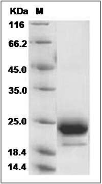 Human TMED4 / ERS25 Protein (His Tag) SDS-PAGE