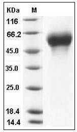 Influenza B virus (B/Florida/4/2006) Hemagglutinin Protein (HA1 Subunit) (His Tag) SDS-PAGE