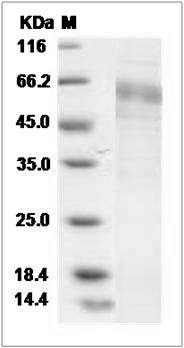 Human ARHI / DIRAS3 Protein (Fc Tag) SDS-PAGE