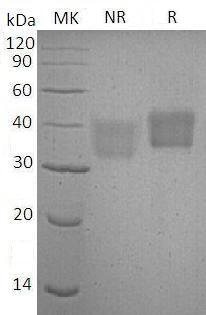 Human CD84/SLAMF5 (His tag) recombinant protein