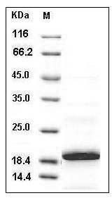 Human 4E-BP1 / EIF4EBP1 Protein (His Tag) SDS-PAGE