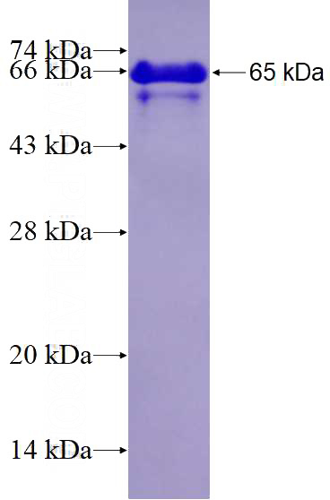 Recombinant Human EAF1 SDS-PAGE