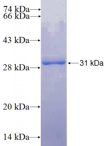 Recombinant Human CIDEC SDS-PAGE