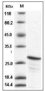 Human CIB2 / KIP-2 Protein (His Tag) SDS-PAGE