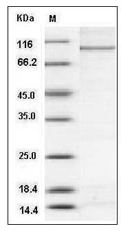 Human PARP-3 / PARP3 Protein (His & GST Tag) SDS-PAGE