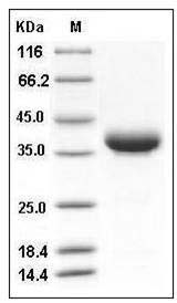 Mouse JAM2 / CD322 / VE-JAM Protein (His Tag) SDS-PAGE