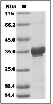 Human BIRC7 / Livin Protein (His Tag) SDS-PAGE
