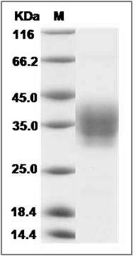 Canine Ephrin-B2 / EFNB2 Protein (His Tag) SDS-PAGE