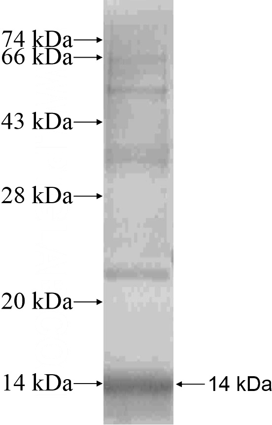 Recombinant Human ATP2A1 SDS-PAGE