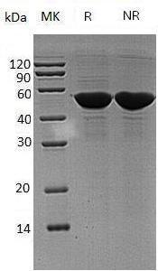 Human PDIA6/ERP5/P5/TXNDC7 (His tag) recombinant protein