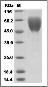 Sudan ebolavirus Glycoprotein / GP Protein (His Tag) SDS-PAGE