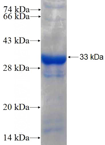 Recombinant Human TRAIL SDS-PAGE