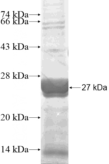 Recombinant Human NR5A2 SDS-PAGE