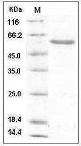 Human NBL1 / DAND1 / DAN Protein (Fc Tag) SDS-PAGE