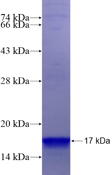 Recombinant Human CCL25 SDS-PAGE