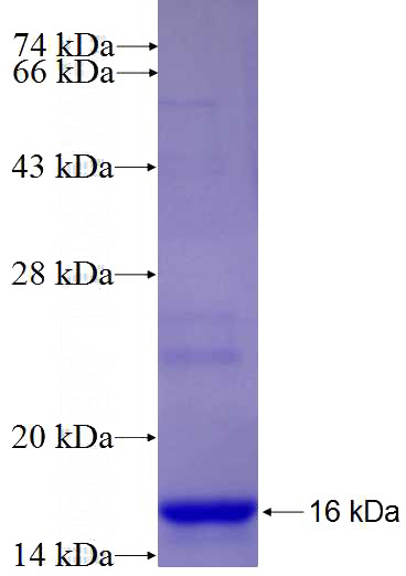 Recombinant Human NEIL2 SDS-PAGE