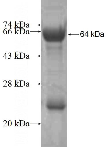 Recombinant Human DCLRE1A SDS-PAGE