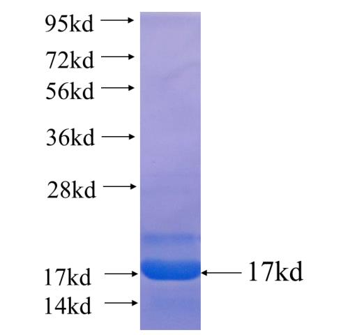 Recombinant human STRN SDS-PAGE
