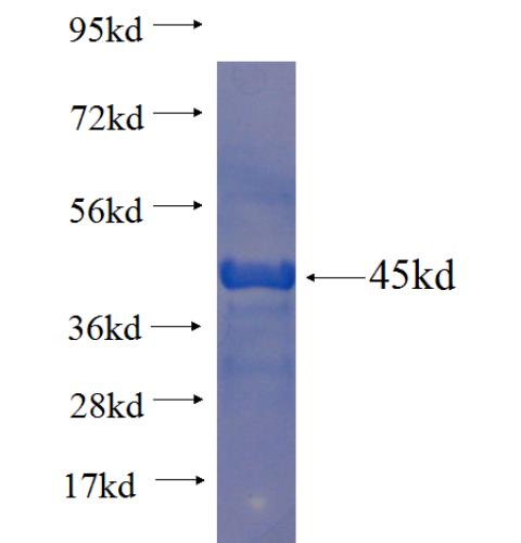 Recombinant human LPPR4 SDS-PAGE
