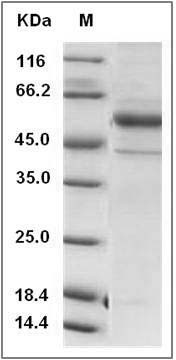 Human NTPDase 2 / ENTPD2 Protein (aa 29-460, His Tag) SDS-PAGE