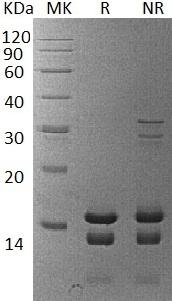 Human PEA15 recombinant protein