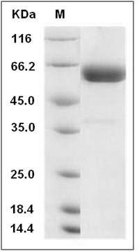 Rat 4-1BBL / CD137L / TNFSF9 Protein (Fc Tag) SDS-PAGE