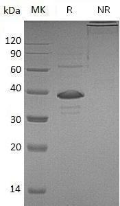 Human IL2RG (Fc tag) recombinant protein
