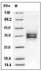 Mouse FOLR1 / FR-alpha Protein (His Tag) SDS-PAGE