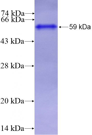Recombinant Human TRIM2 SDS-PAGE