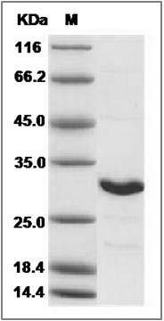 Human NAA10 / ARD1A Protein SDS-PAGE