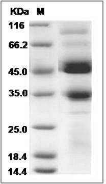 Human BMPR1B / ALK-6 Protein (Fc Tag) SDS-PAGE