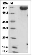 Rat Siglec-2 / CD22 Protein (His Tag)