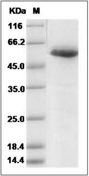 Human CALR / Calreticulin Protein (His Tag) SDS-PAGE
