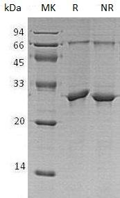 Human PPM1G/PPM1C (His tag) recombinant protein