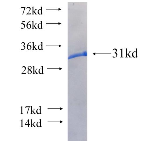 Recombinant human SPNS1 SDS-PAGE
